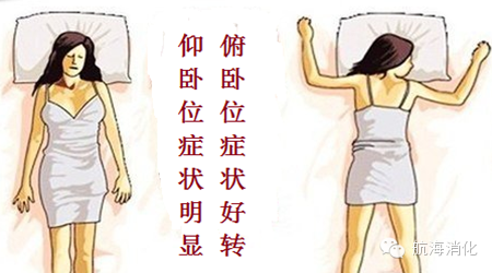 睡姿与消化疾病