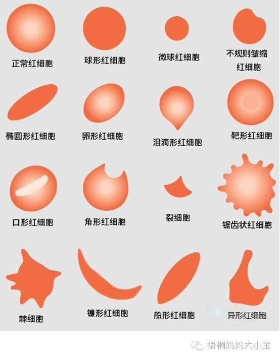 宝宝血色素低到什么程度算贫血，并需要干预治疗？