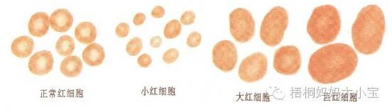 宝宝血色素低到什么程度算贫血，并需要干预治疗？