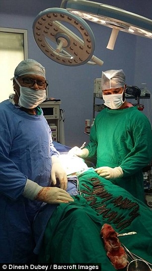 三哥肚痛赴院检查,医生透过X光片赫然发现他胃里尽是“刀片”