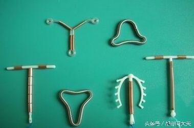 放置节育环需注意哪些事项？