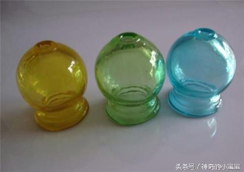 盘点|秋季拔罐的五大好处