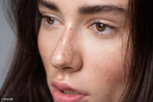 脸上皮肤脂溢性角化斑