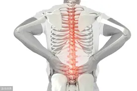 强直性脊柱炎想康复？定期复查不可少！图片