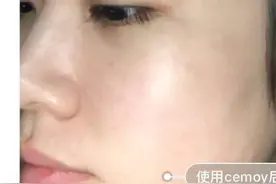 我的21天“换脸之路”！见证皮肤从暗沉到透亮，开心不止一点图片