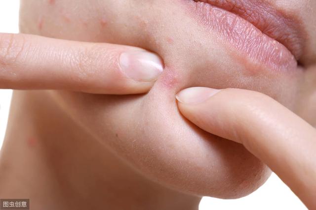 毛囊角化和粟丘疹的区别