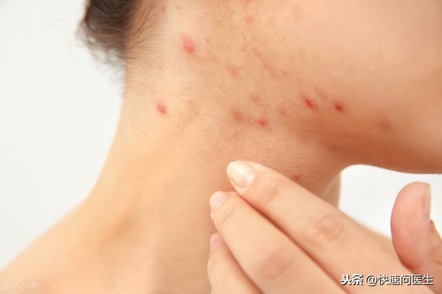 手臂上的小红点是什么？可能是以下3个原因，看下你有没有