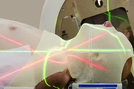 放疗会对身体造成什么损伤？什么情况下会掉头发？图片