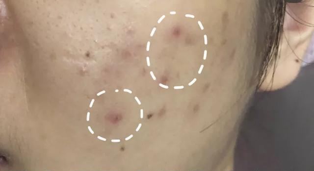 涓嶅埌鐧惧厓鐨勬皑鍩洪吀娲楅潰濂讹紝鑷甫娲侀潰鍒峰ご锛岀毊鑲よ秺娲楄秺婊戞簻