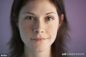 脸上长斑怎么办？了解四个因素，对症治疗图片