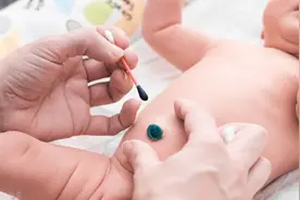 令人揪心的“脐血流”图片