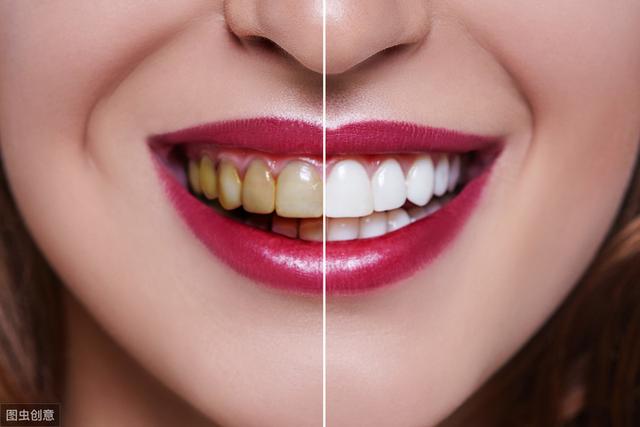 中形容美女"目若玄珠,齿若编贝",就是说美人眼睛如同明珠,牙齿整洁