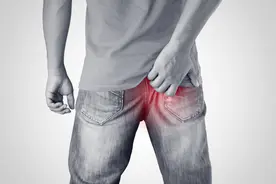 “菊”部地带的拜访者：痔疮图片