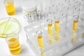 睡觉身体出现这3种变化，说明尿酸超标！1个不占，恭喜肾还健康图片