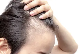 头发干枯细软油腻脱发？快看看是不是身体这个部位出现问题图片