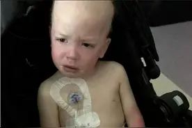 一组5岁姐姐照顾4岁癌症弟弟的照片，看到最后默默地留下了眼泪图片