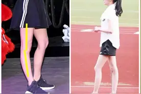 如何摆脱前凸后翘的腿型？改善膝关节超伸是关键，5个动作给到你图片