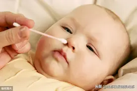 奶娃儿鼻头上的黄白点点是什么东东？能抠掉吗？图片