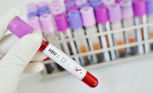 转氨酶是肝脏的“晴雨表”，转氨酶升高就是肝脏出问题了？