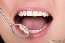 出现牙龈肿痛、口臭火气大是肝的问题？有可能是你脾胃出问题图片