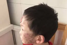 被虐女童亲妈再发声：女儿昏迷，正在借钱！网友却质疑亲妈：有时间换指甲油？图片