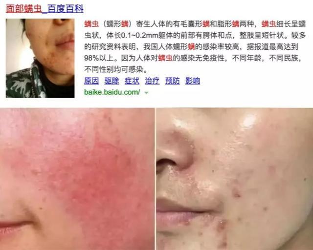 洗面奶中这2种网红护肤成分叠加使用：温和清洁+除螨杀菌＞2？