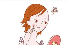 下巴老是长痘痘怎么回事？教你从源头祛痘！图片