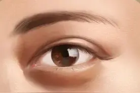 黑眼圈还分种类？来看看你的黑眼圈是什么类型，如何去科学的缓解图片