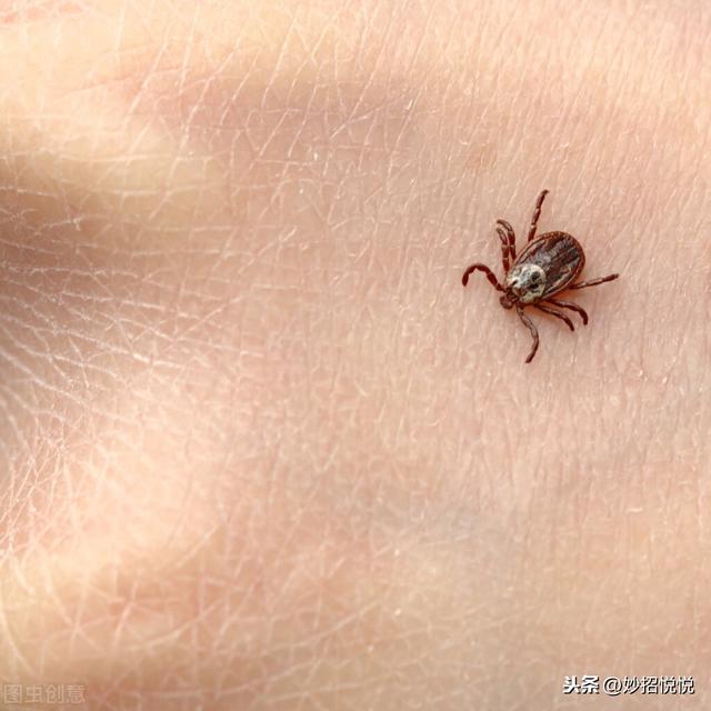 巧妙去除肉眼看不见的螨虫,水里只需加入这2种,干净彻底无残留