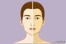 脸上9个变化可能是病？一分钟教你对照自查图片