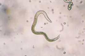 孕期养宠物会感染弓形虫？为什么那些孕妈还在和宠物朝夕相处？图片