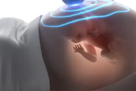 超声下的胎儿美吗？图片