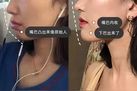 深度解答：整牙的过程是怎样的？干货满满，建议收藏图片