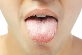 舌头像电锯，性功能也不好？有“齿痕舌”的阳痿病人该如何调理？图片
