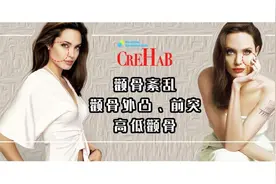 颧骨外凸与高低，两侧颧骨不对称，脸型又太凸，颧骨怎么运动改善图片