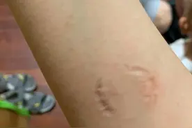 宝宝的小嘴，咬人的魔鬼，如何才能破解？妈妈要清楚娃的真实需求图片