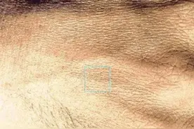 人类皮肤放大了一万倍后，呈现出来的形态，超乎你的想象图片
