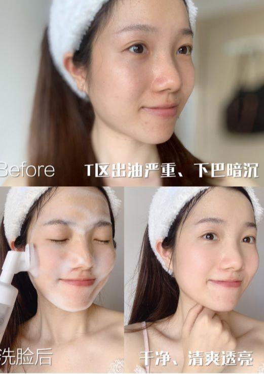 涓嶅埌鐧惧厓鐨勬皑鍩洪吀娲楅潰濂讹紝鑷甫娲侀潰鍒峰ご锛岀毊鑲よ秺娲楄秺婊戞簻