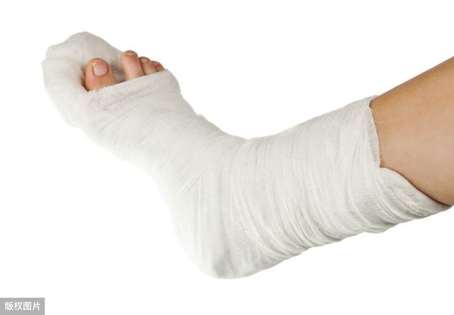 脚崴了一直不消肿怎么办