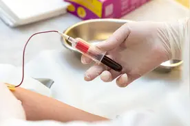 甲状腺疾病如何安排甲功复查频率，看懂这些可以简单地读懂化验单图片