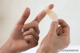 小伤口也会感染？医生：3个误区一定要避免图片