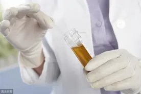 体检发现"尿潜血++"，这是有严重肾病吗？医生讲清楚了，值得细看图片
