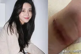 韩女团AOA珉娥二度割腕自杀至神经断裂！血泪控诉经纪公司图片