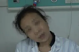西安女子得怪病脖子歪成直角，医生：此病非常痛苦，一定要尽快就医图片