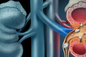 肾里会长出骨头来？我读书少，你别骗我！谈谈细胞化生图片