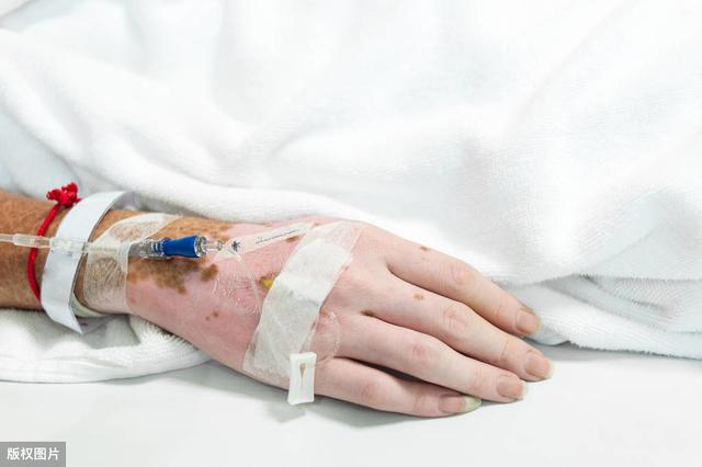 外阴角化用什么药最好