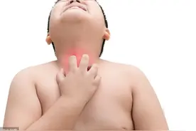 6岁男童卡喉，家属送医晚一步，医生：这个动作能救命一定要学会图片