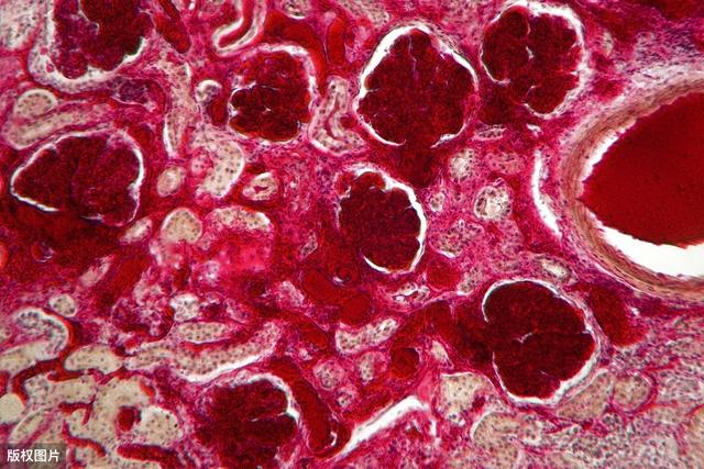 白蛋白后为什么要静推速尿？