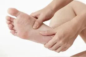 您可知道您的脚底茧子是怎么来的么？拇外翻合并胼胝体图片