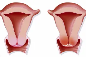 关于子宫肥大，妇科医生如是说图片